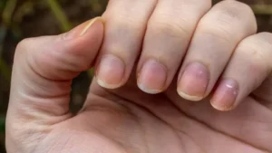 ¿Por qué las uñas se ponen amarillas?
