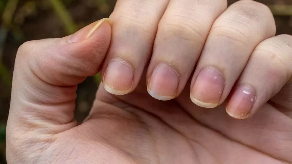 ¿Por qué las uñas se ponen amarillas?